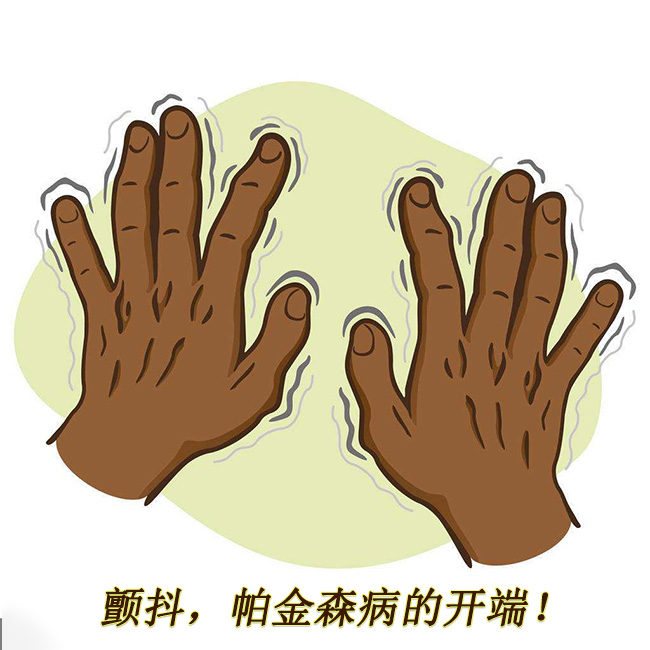 顫抖，帕金森病的開端 帕金森的早期癥狀